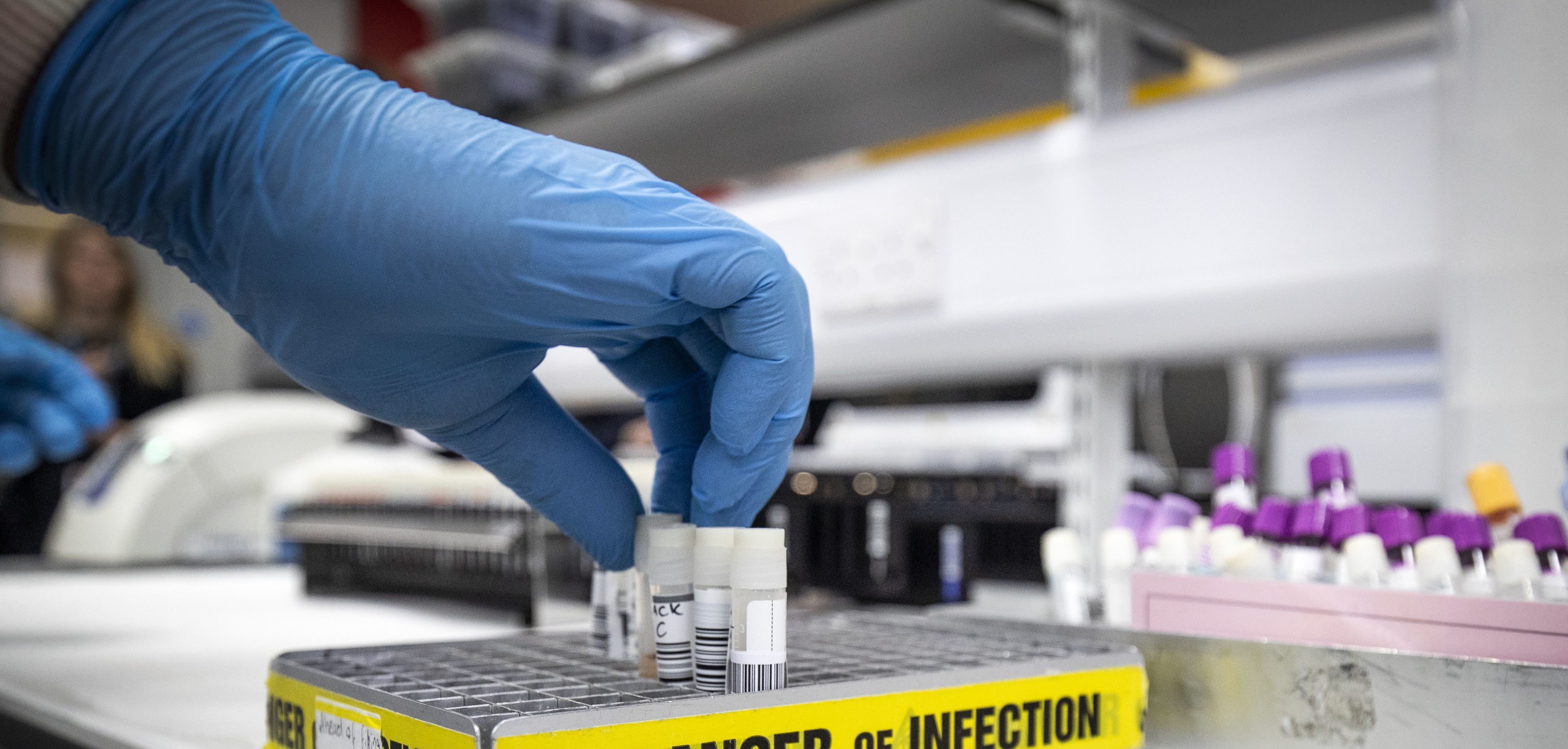 Les tests pour le coronavirus s'accélèrent à Montréal.