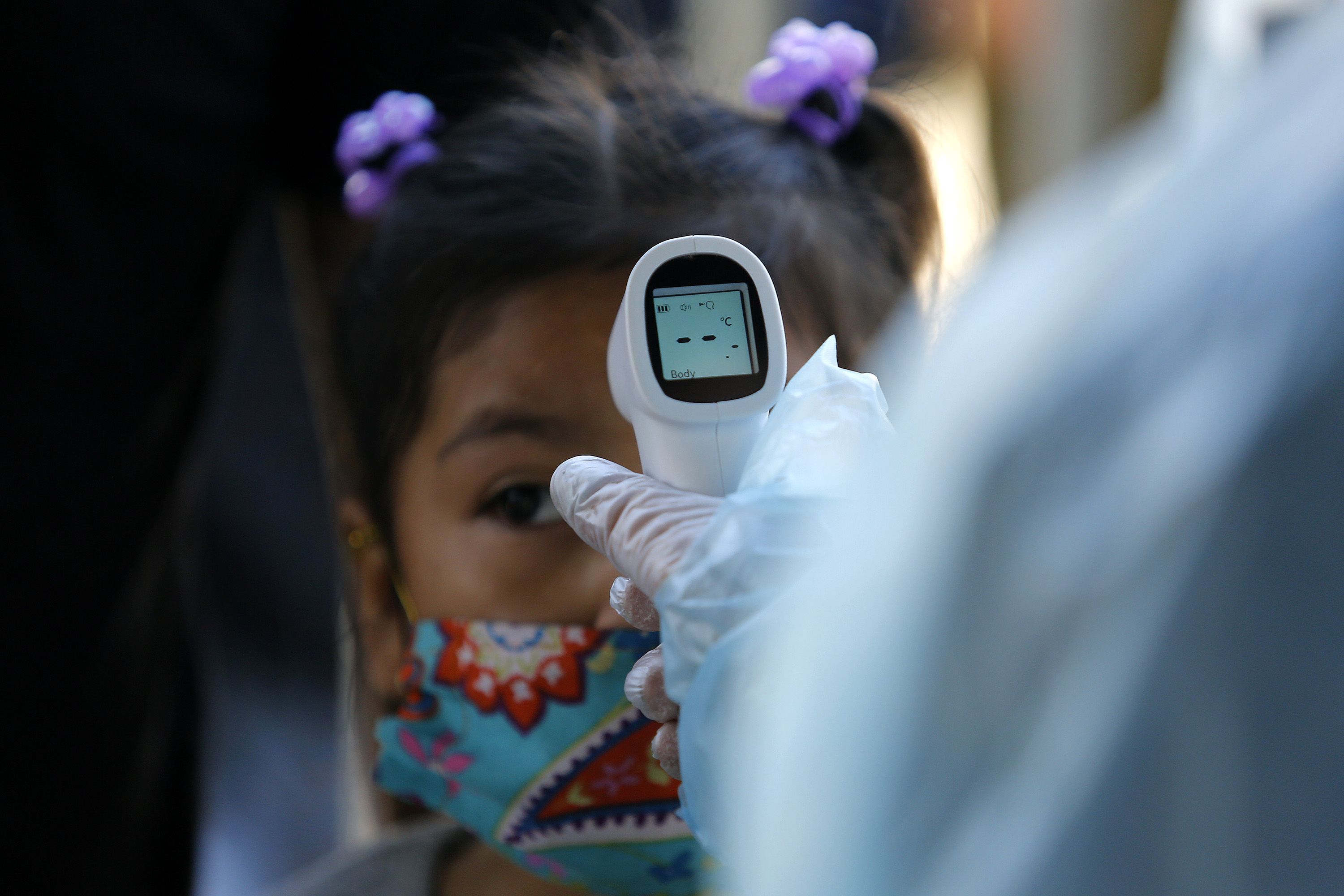 Coronavirus: inquiétudes après des complications inflammatoires chez les enfants