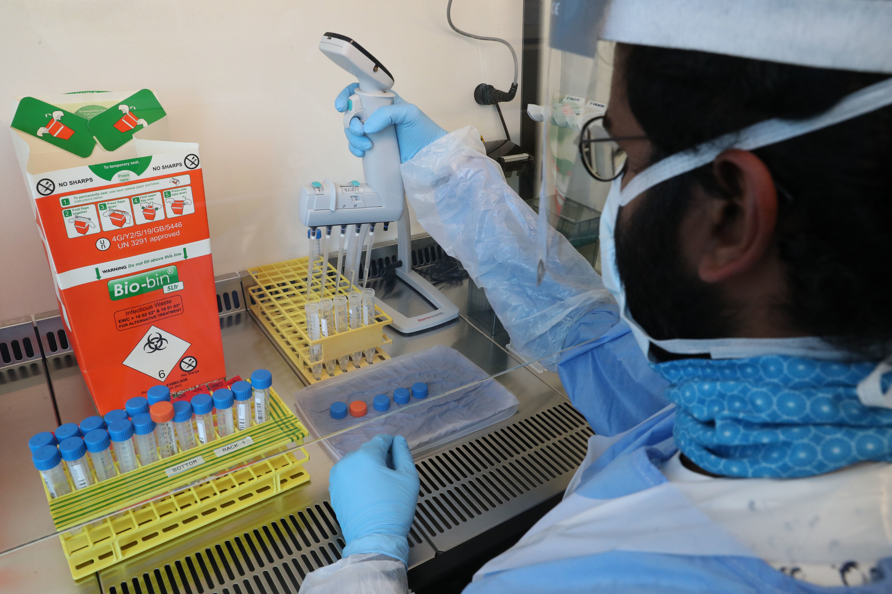 Coronavirus: un anticorps monoclonal prometteur identifié aux Pays-Bas