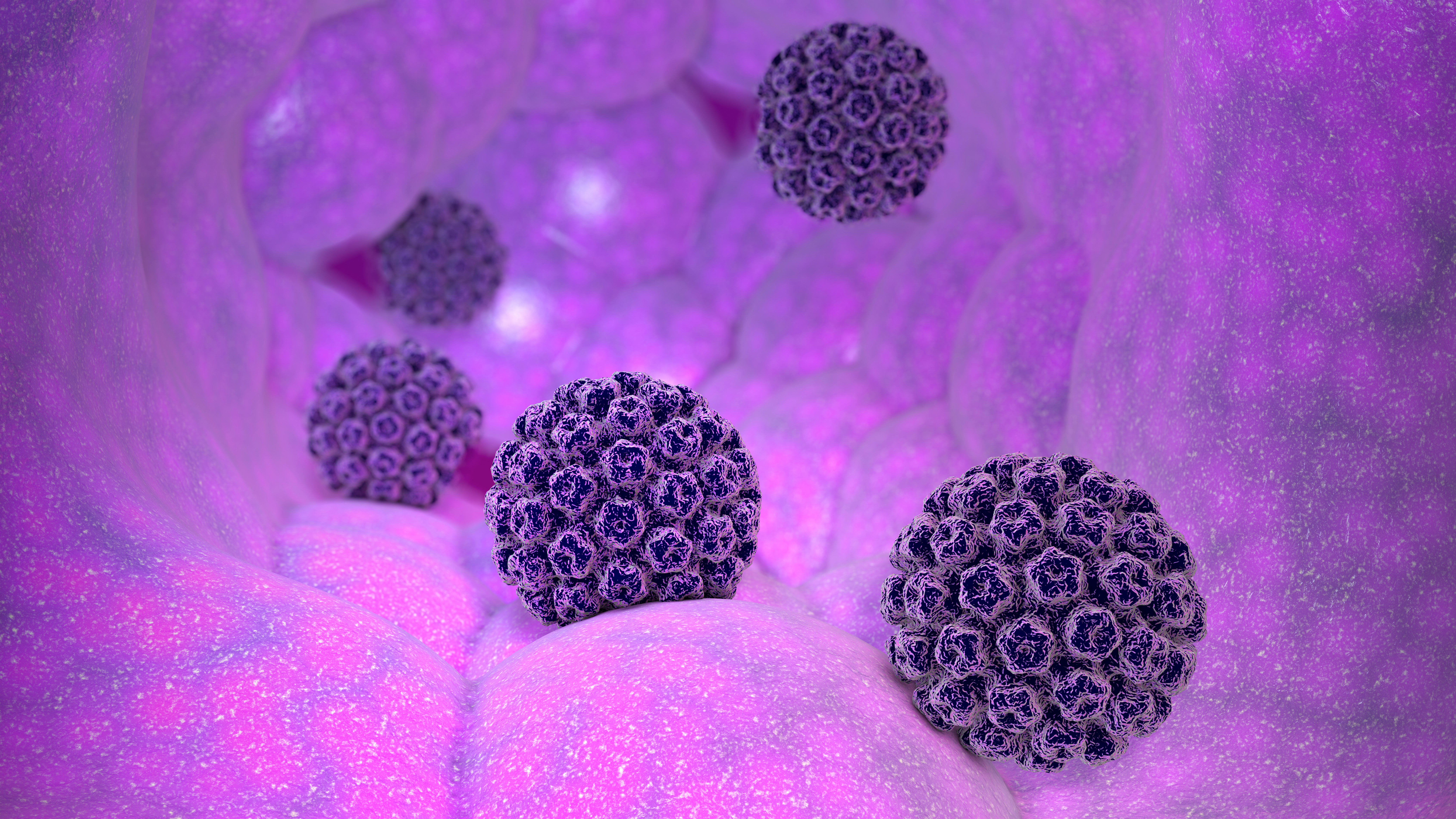 Human papillomavirus infection