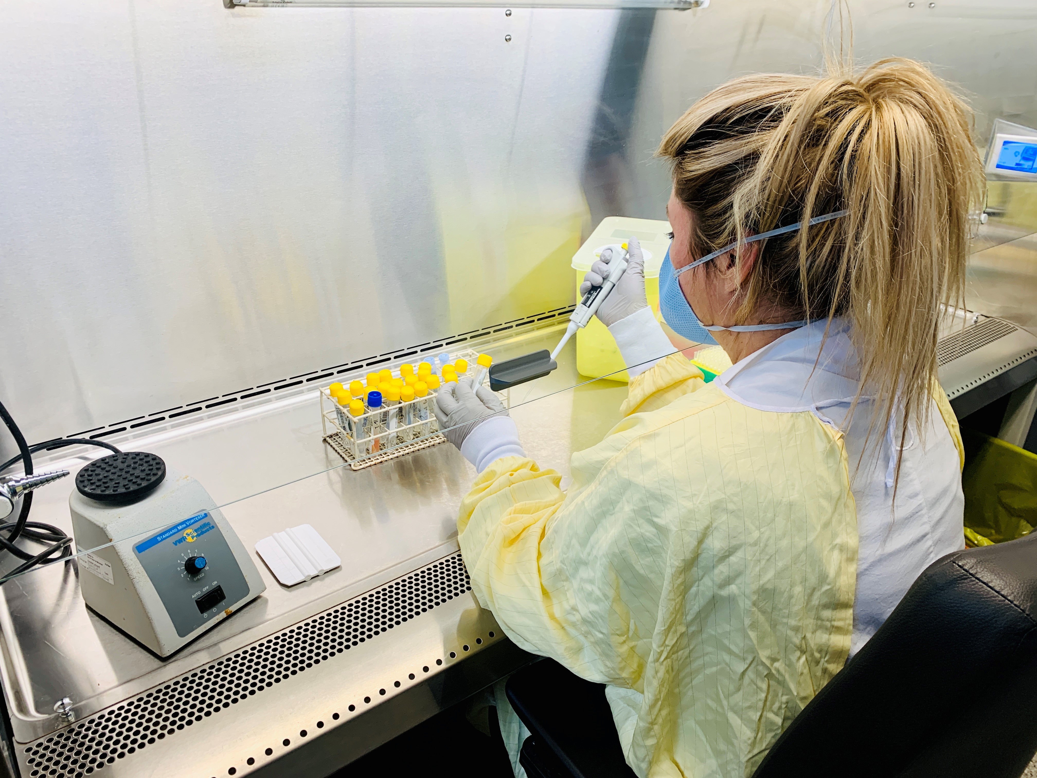 Analyse d'un test de COVID